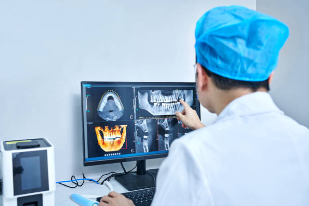 Best Emergency Tooth Extraction in Reno, TX